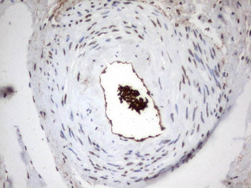 MLF1 Antibody - Immunohistochemical staining of paraffin-embedded Human Ovary tissue using anti-MLF1 mouse monoclonal antibody.  heat-induced epitope retrieval by 1 mM EDTA in 10mM Tris, pH8.0, 120C for 3min)