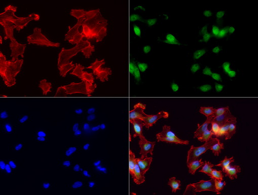 MLF1 Antibody - Immunofluorescent staining of MDA-MB-231 cells using anti-MLF1 mouse monoclonal antibody  green, 1:100). Actin filaments were labeled with TRITC-phalloidin. (red), and nuclear with DAPI. (blue).