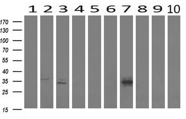 MLF1 Antibody - Western blot analysis of extracts. (10ug) from 10 Human tissue by using anti-MLF1 monoclonal antibody at 1:500. (1: Testis; 2: Omentum; 3: Uterus; 4: Breast; 5: Brain; 6: Liver; 7: Ovary; 8: Thyroid gland; 9: colon;10: spleen).