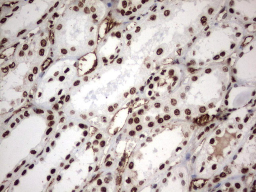 MLF1 Antibody - Immunohistochemical staining of paraffin-embedded Human Kidney tissue using anti-MLF1 mouse monoclonal antibody.  heat-induced epitope retrieval by 1 mM EDTA in 10mM Tris, pH8.0, 120C for 3min)