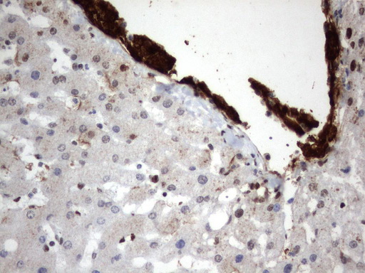 MLF1 Antibody - Immunohistochemical staining of paraffin-embedded Human liver tissue using anti-MLF1 mouse monoclonal antibody.  heat-induced epitope retrieval by 1 mM EDTA in 10mM Tris, pH8.0, 120C for 3min)