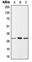 MLF1 Antibody - Western blot analysis of MLF1 expression in HeLa (A); SP2/0 (B); H9C2 (C) whole cell lysates.
