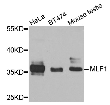 MLF1 Antibody - Western blot analysis of extracts of various cells.