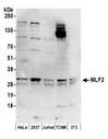 MLF2 Antibody - Detection of human and mouse MLF2 by western blot. Samples: Whole cell lysate (50 µg) from HeLa, HEK293T, Jurkat, mouse TCMK-1, and mouse NIH 3T3 cells prepared using NETN lysis buffer. Antibodies: Affinity purified rabbit anti-MLF2 antibody used for WB at 0.1 µg/ml. Detection: Chemiluminescence with an exposure time of 3 minutes.