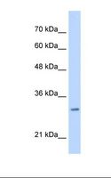 MLF2 Antibody - Jurkat cell lysate. Antibody concentration: 0.25 ug/ml. Gel concentration: 12%.  This image was taken for the unconjugated form of this product. Other forms have not been tested.