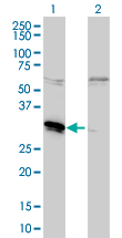 MLF2 Antibody - Western blot of MLF2 expression in transfected 293T cell line by MLF2 monoclonal antibody (M01), clone 2F6-1E3.