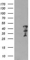 MLF2 Antibody - HEK293T cells were transfected with the pCMV6-ENTRY control (Left lane) or pCMV6-ENTRY MLF2 (Right lane) cDNA for 48 hrs and lysed. Equivalent amounts of cell lysates (5 ug per lane) were separated by SDS-PAGE and immunoblotted with anti-MLF2.