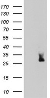 MLF2 Antibody - HEK293T cells were transfected with the pCMV6-ENTRY control (Left lane) or pCMV6-ENTRY MLF2 (Right lane) cDNA for 48 hrs and lysed. Equivalent amounts of cell lysates (5 ug per lane) were separated by SDS-PAGE and immunoblotted with anti-MLF2.