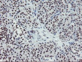 MLF2 Antibody - IHC of paraffin-embedded Human pancreas tissue using anti-MLF2 mouse monoclonal antibody. (Heat-induced epitope retrieval by 10mM citric buffer, pH6.0, 100C for 10min).