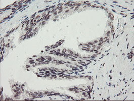 MLF2 Antibody - IHC of paraffin-embedded Human prostate tissue using anti-MLF2 mouse monoclonal antibody. (Heat-induced epitope retrieval by 10mM citric buffer, pH6.0, 100C for 10min).