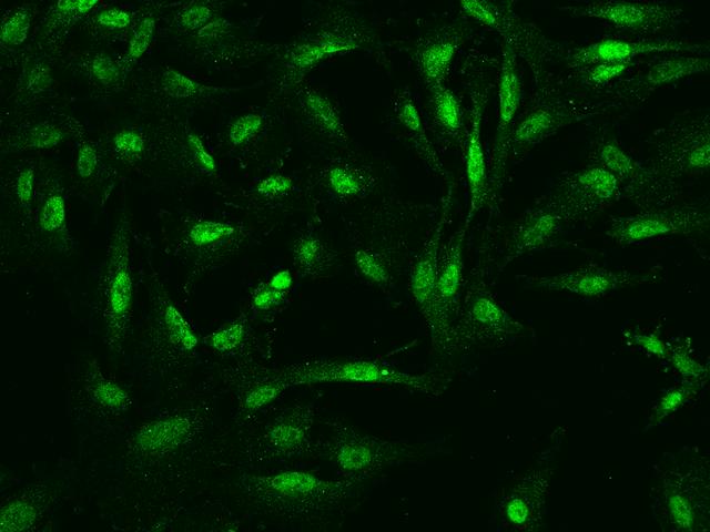 MLF2 Antibody - Immunofluorescence staining of MLF2 in U251MG cells. Cells were fixed with 4% PFA, permeabilzed with 0.1% Triton X-100 in PBS, blocked with 10% serum, and incubated with rabbit anti-Human MLF2 polyclonal antibody (dilution ratio 1:200) at 4°C overnight. Then cells were stained with the Alexa Fluor 488-conjugated Goat Anti-rabbit IgG secondary antibody (green). Positive staining was localized to Nucleus and cytoplasm.