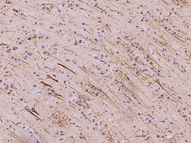 MLF2 Antibody - Immunochemical staining of human MLF2 in human brain with rabbit polyclonal antibody at 1:500 dilution, formalin-fixed paraffin embedded sections.