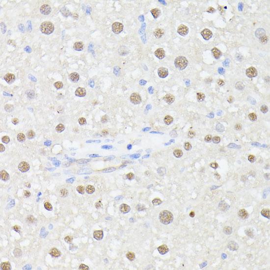 MLF2 Antibody - Immunohistochemistry of paraffin-embedded Rat liver using MLF2 Polyclonal Antibody at dilution of 1:100 (40x lens).