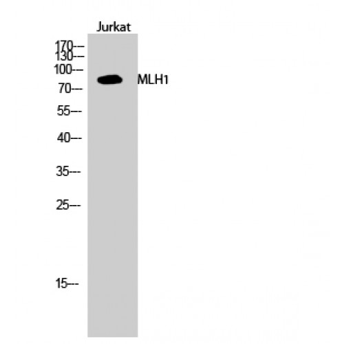 MLH1 Antibody - Western blot of MLH1 antibody