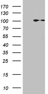 MLH1 Antibody - HEK293T cells were transfected with the pCMV6-ENTRY control. (Left lane) or pCMV6-ENTRY MLH1. (Right lane) cDNA for 48 hrs and lysed