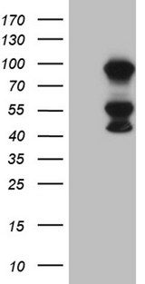 MLH1 Antibody - HEK293T cells were transfected with the pCMV6-ENTRY control. (Left lane) or pCMV6-ENTRY MLH1. (Right lane) cDNA for 48 hrs and lysed. Equivalent amounts of cell lysates. (5 ug per lane) were separated by SDS-PAGE and immunoblotted with anti-MLH1. (1:2000)