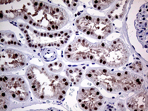 MLH1 Antibody - Immunohistochemical staining of paraffin-embedded Human Kidney tissue within the normal limits using anti-MLH1 mouse monoclonal antibody. (Heat-induced epitope retrieval by 1mM EDTA in 10mM Tris buffer. (pH8.5) at 120°C for 3 min. (1:1000)