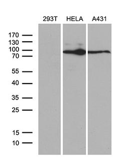 MLH1 Antibody - Western blot analysis of extracts. (35ug) from 3 different cell lines by using anti-MLH1 monoclonal antibody. (1:500)