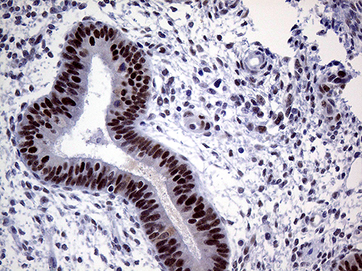 MLH1 Antibody - Immunohistochemical staining of paraffin-embedded Human endometrium tissue within the normal limits using anti-MLH1 mouse monoclonal antibody. (Heat-induced epitope retrieval by 1mM EDTA in 10mM Tris buffer. (pH8.5) at 120°C for 3 min. (1:1000)