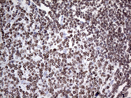 MLH1 Antibody - Immunohistochemical staining of paraffin-embedded Human lymph node tissue within the normal limits using anti-MLH1 mouse monoclonal antibody. (Heat-induced epitope retrieval by 1mM EDTA in 10mM Tris buffer. (pH8.5) at 120°C for 3 min. (1:500)