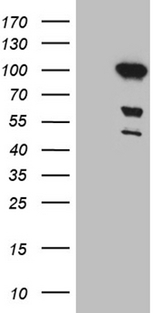 MLH1 Antibody - HEK293T cells were transfected with the pCMV6-ENTRY control. (Left lane) or pCMV6-ENTRY MLH1. (Right lane) cDNA for 48 hrs and lysed. Equivalent amounts of cell lysates. (5 ug per lane) were separated by SDS-PAGE and immunoblotted with anti-MLH1. (1:2000)