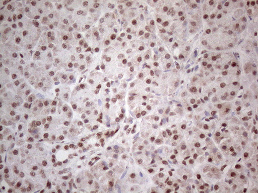 MLH1 Antibody - Immunohistochemical staining of paraffin-embedded Human pancreas tissue using anti-MLH1 mouse monoclonal antibody. (Heat-induced epitope retrieval by 1mM EDTA in 10mM Tris buffer. (pH8.0) at 110C for 10 min. (1:200)