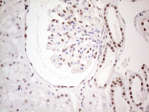 MLH1 Antibody - Immunohistochemical staining of paraffin-embedded Human Kidney tissue using anti-MLH1 mouse monoclonal antibody. (Heat-induced epitope retrieval by 1mM EDTA in 10mM Tris buffer. (pH8.0) at 110C for 10 min. (1:200)