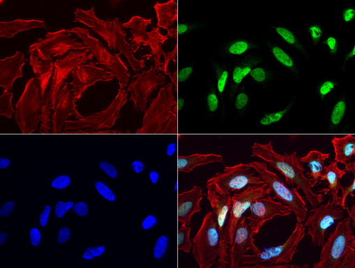 MLH1 Antibody - Immunofluorescent staining of HeLa cells using anti-MLH1 mouse monoclonal antibody  green, 1:50). Actin filaments were labeled with Alexa Fluor® 594 Phalloidin. (red), and nuclear with DAPI. (blue).