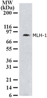 MLH1 Antibody - Western blot of MLH1 in Molt-4 cell lysate using antibody at 2 ug/ml, and exposed for 15 minutes.