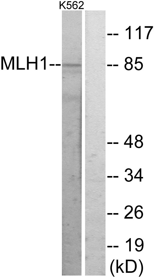 MLH1 Antibody - Western blot analysis of lysates from K562 cells, using MLH1 Antibody. The lane on the right is blocked with the synthesized peptide.