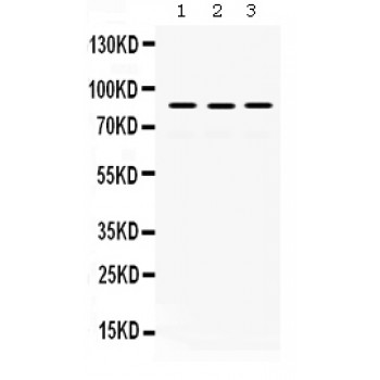 MLH1 Antibody - MLH1 antibody Western blot. All lanes: Anti MLH1 at 0.5 ug/ml. Lane 1: Rat Lung Tissue Lysate at 50 ug. Lane 2: Mouse Testis Tissue Lysate at 50 ug. Lane 3: COLO320 Whole Cell Lysate at 40 ug. Predicted band size: 84 kD. Observed band size: 84 kD.