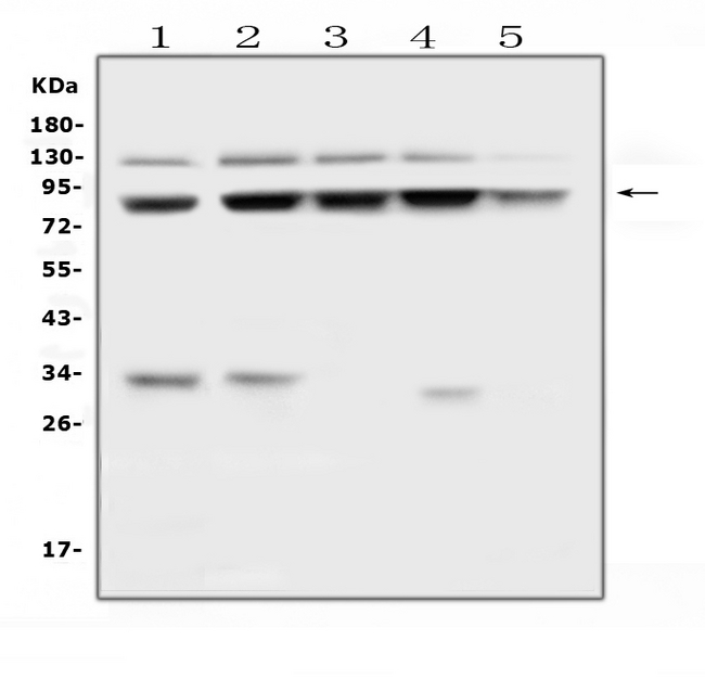 MLH1 Antibody - Western blot analysis of MLH1 using anti-MLH1 antibody. Electrophoresis was performed on a 5-20% SDS-PAGE gel at 70V (Stacking gel) / 90V (Resolving gel) for 2-3 hours. The sample well of each lane was loaded with 50ug of sample under reducing conditions. Lane 1: human HEK293 whole cell lysates, Lane 2: human Hela whole cell lysates, Lane 3: human COLO-320 whole cell lysates, Lane 4: human T-47D whole cell lysates, Lane 5: human A549 whole cell lysates. After Electrophoresis, proteins were transferred to a Nitrocellulose membrane at 150mA for 50-90 minutes. Blocked the membrane with 5% Non-fat Milk/ TBS for 1.5 hour at RT. The membrane was incubated with rabbit anti-MLH1 antigen affinity purified polyclonal antibody at 0.5 µg/mL overnight at 4°C, then washed with TBS-0.1% Tween 3 times with 5 minutes each and probed with a goat anti-rabbit IgG-HRP secondary antibody at a dilution of 1:10000 for 1.5 hour at RT. The signal is developed using an Enhanced Chemiluminescent detection (ECL) kit with Tanon 5200 system. A specific band was detected for MLH1 at approximately 85KD. The expected band size for MLH1 is at 85KD.