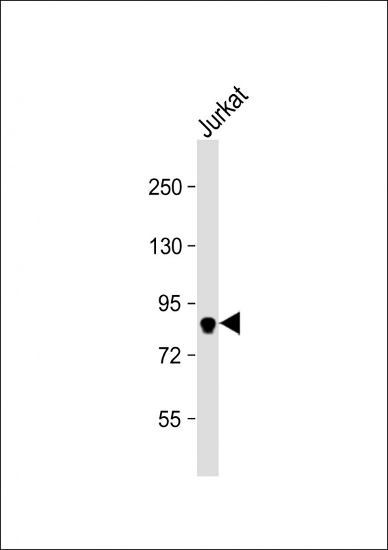 MLH1 Antibody - Anti-MLH1 Antibody (C-term) at 1:1000 dilution + Jurkat whole cell lysate Lysates/proteins at 20 µg per lane. Secondary Goat Anti-Rabbit IgG, (H+L), Peroxidase conjugated at 1/10000 dilution. Predicted band size: 85 kDa Blocking/Dilution buffer: 5% NFDM/TBST.