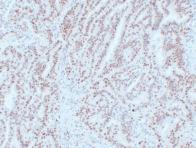 MLH1 Antibody - Colon 1