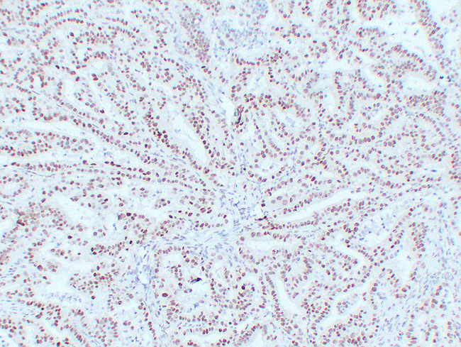 MLH1 Antibody - Colon 2