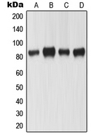 MLH1 Antibody - Western blot analysis of MLH1 expression in KNRK (A); HeLa (B); A431 (C); SW480 (D) whole cell lysates.
