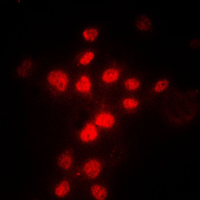 MLH1 Antibody - Immunofluorescent analysis of MLH1 staining in HeLa cells. Formalin-fixed cells were permeabilized with 0.1% Triton X-100 in TBS for 5-10 minutes and blocked with 3% BSA-PBS for 30 minutes at room temperature. Cells were probed with the primary antibody in 3% BSA-PBS and incubated overnight at 4 C in a humidified chamber. Cells were washed with PBST and incubated with a DyLight 594-conjugated secondary antibody (red) in PBS at room temperature in the dark. DAPI was used to stain the cell nuclei (blue).