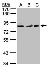 MLH1 Antibody - Sample (30 ug of whole cell lysate). A: A549. 7.5% SDS PAGE. MLH1 antibody diluted at 1:1000. 