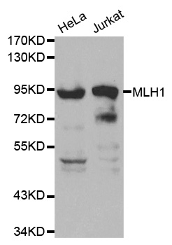 MLH1 Antibody - Western blot analysis of extracts of various cell lines, using MLH1 antibody.