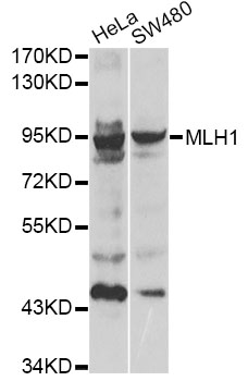 MLH1 Antibody - Western blot analysis of extracts of various cell lines, using MLH1 antibody. The secondary antibody used was an HRP Goat Anti-Rabbit IgG (H+L) at 1:10000 dilution. Lysates were loaded 25ug per lane and 3% nonfat dry milk in TBST was used for blocking.