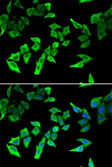 MLH1 Antibody - Immunofluorescence analysis of U2OS cells using MLH1 antibody. Blue: DAPI for nuclear staining.