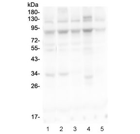 MLH1 Antibody - Western blot testing of 1) rat lung, 2) mouse testis and 3) human COLO320 lysate with MLH1 antibody. Predicted molecular weight: 85/58/74 kDa (isoforms 1/2/3).