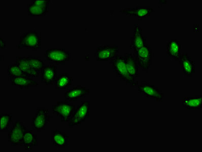 MLH1 Antibody - Immunofluorescent analysis of Hela cells diluted at 1:100 and Alexa Fluor 488-congugated AffiniPure Goat Anti-Rabbit IgG(H+L)