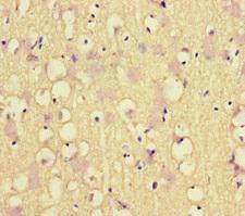 MLH1 Antibody - Immunohistochemistry of paraffin-embedded human brain tissue at dilution of 1:100