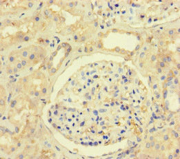 MLH1 Antibody - Immunohistochemistry of paraffin-embedded human kidney tissue at dilution of 1:100