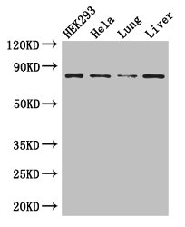 MLH1 Antibody - Western Blot Positive WB detected in:HEK293 whole cell lysate,Hela whole cell lysate,Mouse lung tissue,Mouse liver tissue All Lanes: MLH1 antibody at 3ug/ml Secondary Goat polyclonal to rabbit IgG at 1/50000 dilution Predicted band size: 85,59,74 kDa Observed band size: 85 kDa