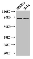 MLH1 Antibody - Western Blot Positive WB detected in: HEK293 whole cell lysate, Hela whole cell lysate All lanes: MLH1 antibody at 3µg/ml Secondary Goat polyclonal to rabbit IgG at 1/50000 dilution Predicted band size: 85, 59, 74 kDa Observed band size: 85 kDa