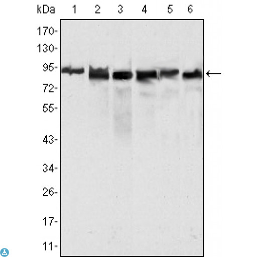 MLH1 Antibody - Western Blot (WB) analysis using MLH1 Monoclonal Antibody against HeLa (1), MCF-7 (2) and A549 (3), Jurkat (4), 2R75 (5) and COS (6) cell lysate.