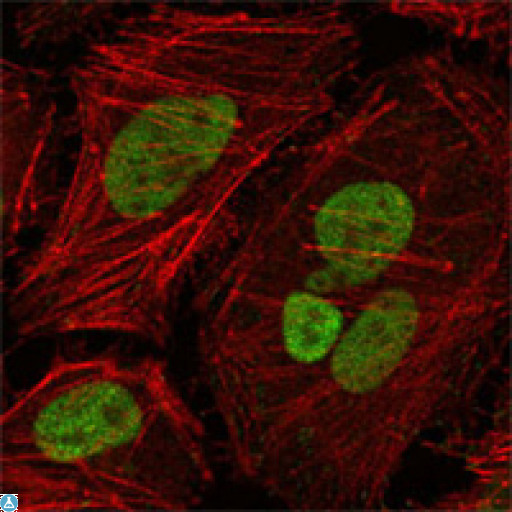 MLH1 Antibody - Confocal Immunofluorescence (IF) analysis of HeLa cells using MLH1 Monoclonal Antibody (green), showing nuclear localization. Red: Actin filaments have been labeled with Alexa Fluor-555 phalloidin.