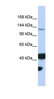 MLH3 Antibody - MLH3 antibody Western blot of 293T cell lysate. This image was taken for the unconjugated form of this product. Other forms have not been tested.